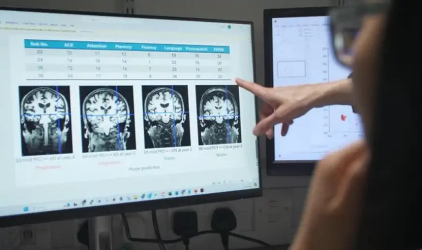 New AI tool diagnoses Alzheimer's more accurately than traditional clinical tests